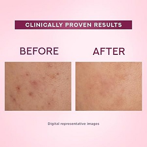 Pond's Bright Beauty Light Cream - Image 2